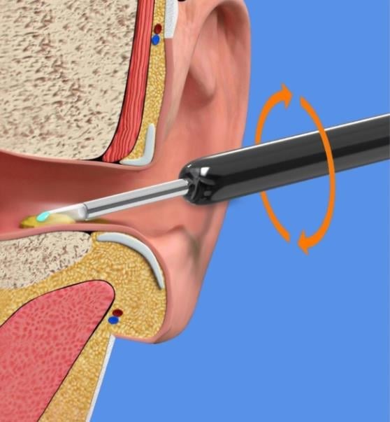 🔥🔥Wireless WIFI Visual Ear Pick